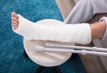 broken bone