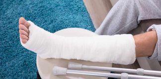 broken bone